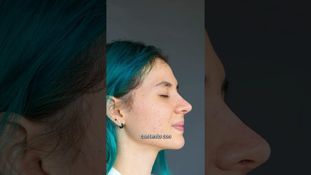 Rinoplastia funcional: cuándo la cirugía corrige problemas respiratorios Rinoplastia funcional: cuándo la cirugía corrige problemas respiratorios